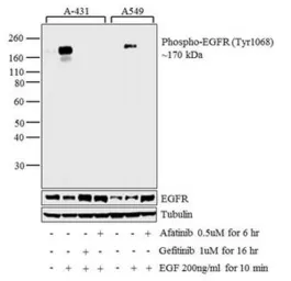 Anti-EGFR (phospho Tyr1068) antibody used in Western Blot (WB). GTX25644