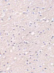 Anti-CIDE A antibody used in IHC (Paraffin sections) (IHC-P). GTX25692