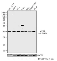 Anti-c-Fos antibody used in Western Blot (WB). GTX25794