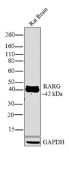 Anti-Retinoic Acid Receptor gamma antibody used in Western Blot (WB). GTX25904