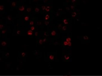 Anti-DcR1 antibody used in Immunocytochemistry/ Immunofluorescence (ICC/IF). GTX25975