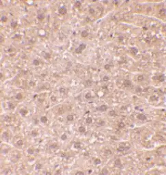 Anti-DEDAF antibody used in Immunohistochemistry (IHC). GTX25976
