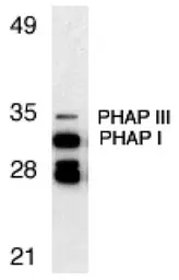 Anti-PHAP antibody used in Western Blot (WB). GTX25987
