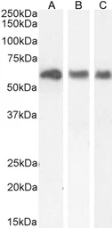 Anti-KPNA3 antibody, C-term used in Western Blot (WB). GTX26038