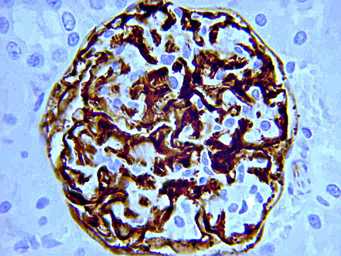 Anti-Nestin antibody [2Q178] used in IHC (Paraffin sections) (IHC-P). GTX26142