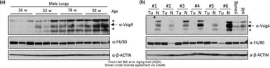 Anti-F4/80 antibody [CI:A3-1] used in Western Blot (WB). GTX26640