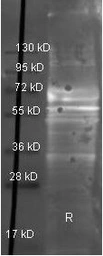 Anti-Fibrinogen antibody used in Western Blot (WB). GTX26666