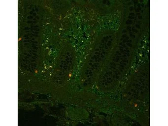 Anti-TNF alpha antibody used in IHC (Paraffin sections) (IHC-P). GTX26671