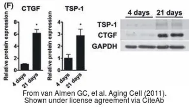 Anti-CTGF antibody used in Western Blot (WB). GTX26992