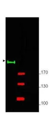 Anti-Gli2 antibody used in Western Blot (WB). GTX27195