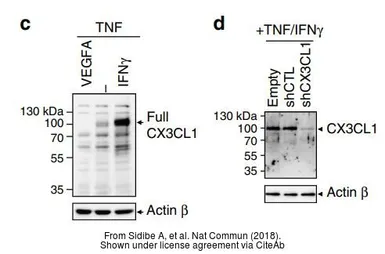 Anti-CX3CR1 antibody used in Western Blot (WB). GTX27200