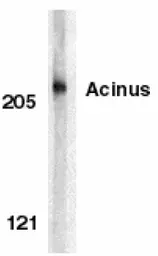 Anti-Acinus antibody used in Western Blot (WB). GTX27355