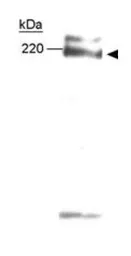Anti-ABCA1 antibody used in Western Blot (WB). GTX27360