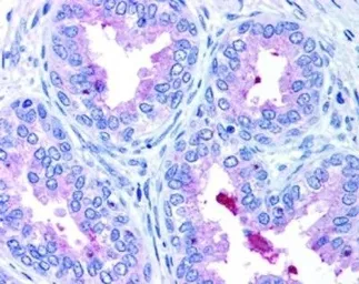 Anti-ABCA1 antibody used in IHC (Paraffin sections) (IHC-P). GTX27360