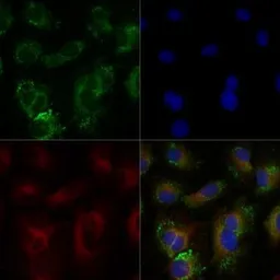 Anti-ABCA1 antibody used in Immunocytochemistry/ Immunofluorescence (ICC/IF). GTX27360