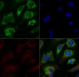 Anti-ABCA1 antibody used in Immunocytochemistry/ Immunofluorescence (ICC/IF). GTX27360