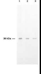 Anti-Thymidylate synthase antibody used in  (). GTX27398