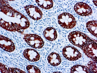 Anti-Cytokeratin 8 antibody [35βH11] (ready-to-use) used in IHC (Paraffin sections) (IHC-P). GTX27506