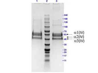 Bovine Collagen IV protein. GTX27529-pro