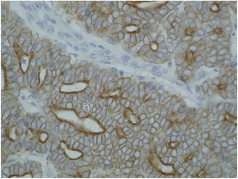 Anti-pan Cytokeratin antibody [C-11] used in IHC (Paraffin sections) (IHC-P). GTX27753