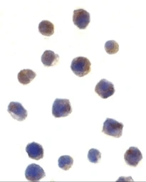 Anti-Chk2 antibody used in Immunocytochemistry/ Immunofluorescence (ICC/IF). GTX28108