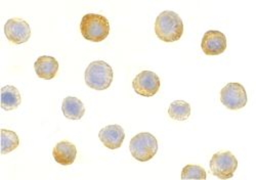 Anti-IL1RAP antibody used in Immunocytochemistry/ Immunofluorescence (ICC/IF). GTX28109