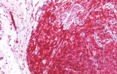 Anti-CD45RA antibody [MEM-56] used in IHC (Paraffin sections) (IHC-P). GTX28217