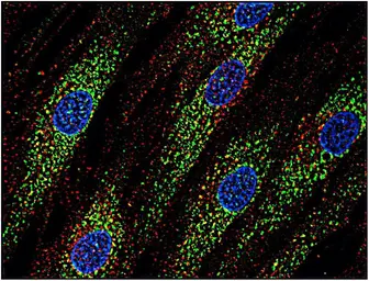 Anti-CD63 antibody [MEM-259] used in Immunocytochemistry/ Immunofluorescence (ICC/IF). GTX28219