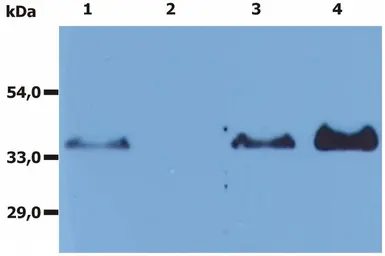 Anti-CD20 antibody [MEM-97] used in Immunoprecipitation (IP). GTX28237