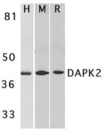 Anti-DAP Kinase 2 antibody used in Western Blot (WB). GTX28404
