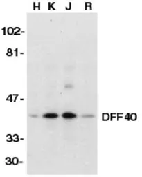 Anti-DFFB antibody used in Western Blot (WB). GTX28406
