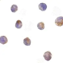Anti-DFFB antibody used in Immunocytochemistry/ Immunofluorescence (ICC/IF). GTX28407