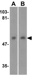 Anti-DR4 antibody used in Western Blot (WB). GTX28414