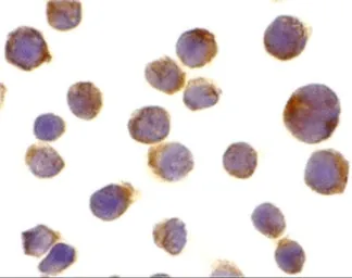 Anti-DR4 antibody used in Immunocytochemistry/ Immunofluorescence (ICC/IF). GTX28414
