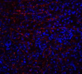 Anti-DR4 antibody used in IHC (Paraffin sections) (IHC-P). GTX28414