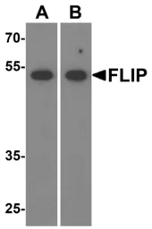Anti-FLIP antibody used in Western Blot (WB). GTX28421