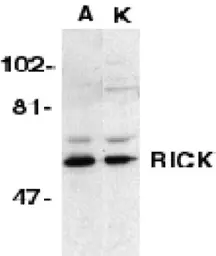 Anti-RIP2 antibody used in Western Blot (WB). GTX28428