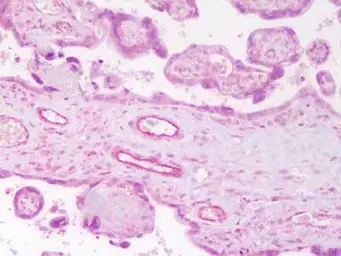 Anti-Angiopoietin 2 antibody used in IHC (Paraffin sections) (IHC-P). GTX28452