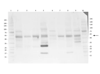 Anti-AKT (phospho Thr308) antibody used in Western Blot (WB). GTX28933