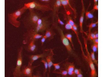 Anti-PPAR alpha antibody used in Immunocytochemistry/ Immunofluorescence (ICC/IF). GTX28934
