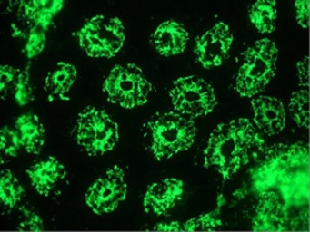 Anti-Cytokeratin 8 antibody [RCK106] used in IHC (Frozen sections) (IHC-Fr). GTX29219