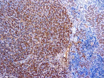 Anti-alpha 1 Antitrypsin antibody used in IHC (Paraffin sections) (IHC-P). GTX29373