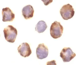 Anti-PUMA antibody used in Immunocytochemistry/ Immunofluorescence (ICC/IF). GTX29643