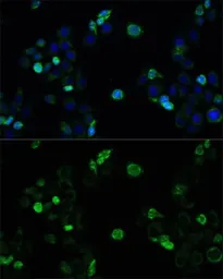 Anti-MRP4 antibody used in Immunocytochemistry/ Immunofluorescence (ICC/IF). GTX30016