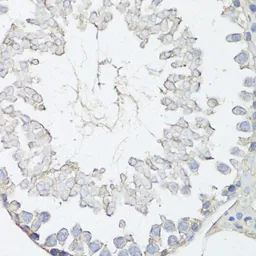 Anti-MRP4 antibody used in IHC (Paraffin sections) (IHC-P). GTX30016