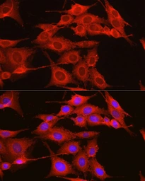 Anti-ADAM9 antibody used in Immunocytochemistry/ Immunofluorescence (ICC/IF). GTX30025