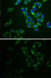 Anti-Adenylate kinase 1 antibody used in Immunocytochemistry/ Immunofluorescence (ICC/IF). GTX30037