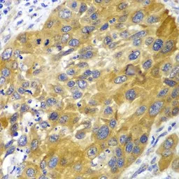 Anti-Adenylate kinase 1 antibody used in IHC (Paraffin sections) (IHC-P). GTX30037