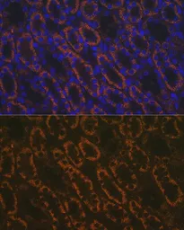 Anti-AMACR antibody used in IHC (Paraffin sections) (IHC-P). GTX30045