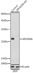 Anti-Rho GDI alpha antibody used in Western Blot (WB). GTX30064